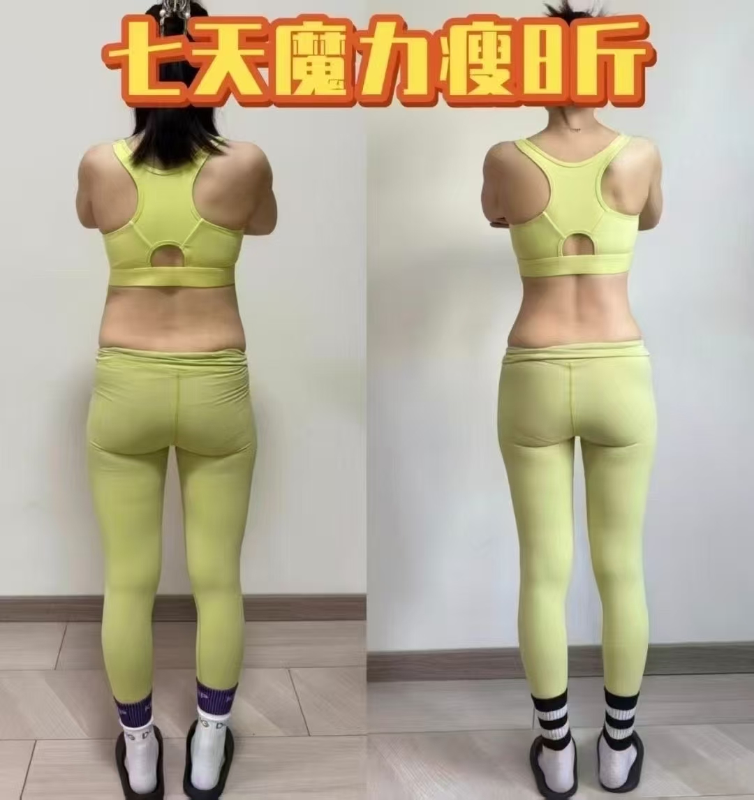 产后修复案例示意