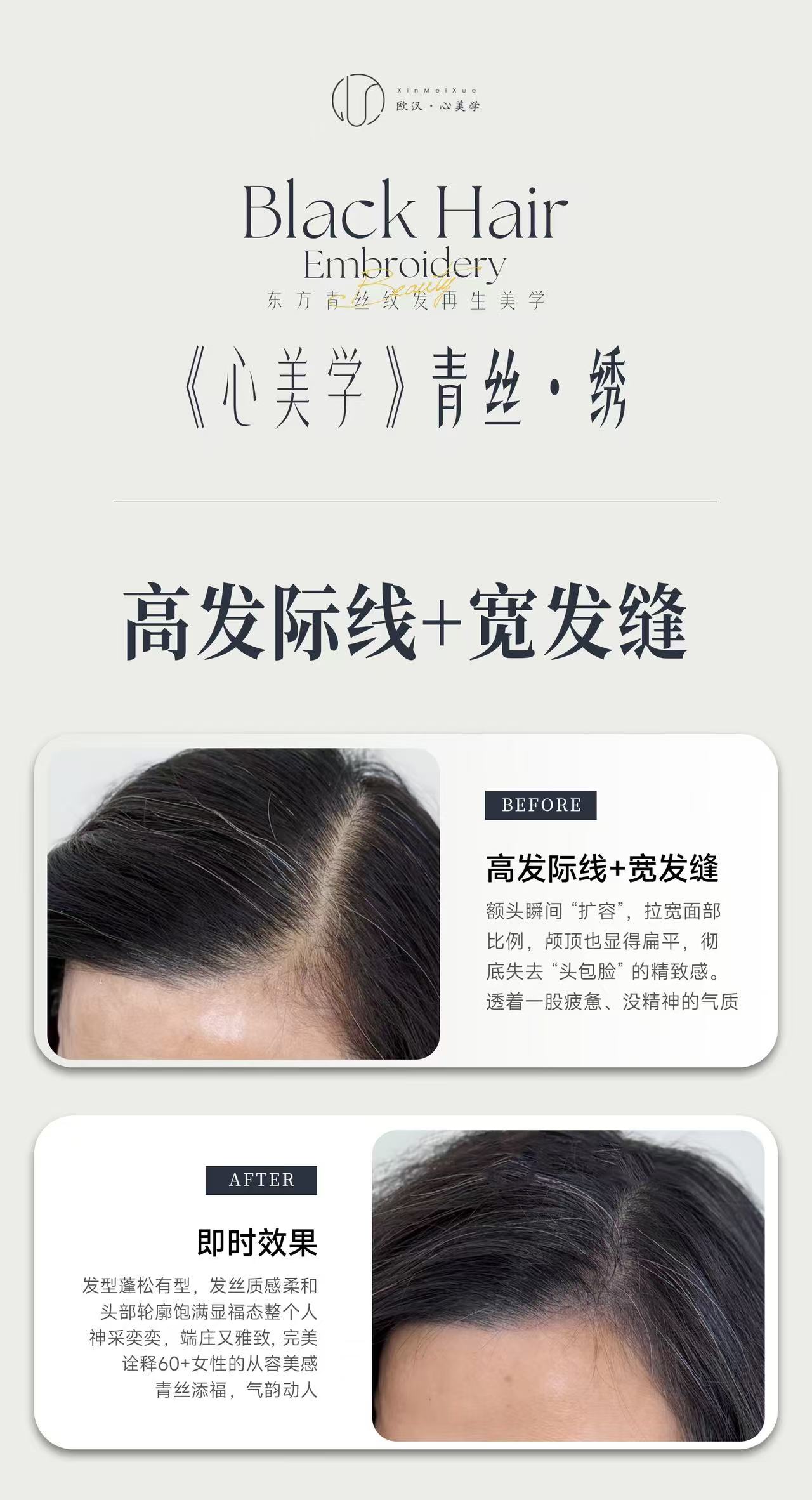 高发际线+宽发缝.jpg